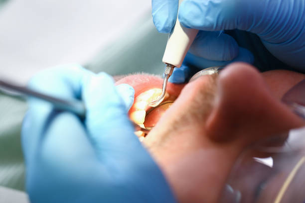 Best Emergency Dentist for Knocked-Out Tooth in Mountainhome, PA